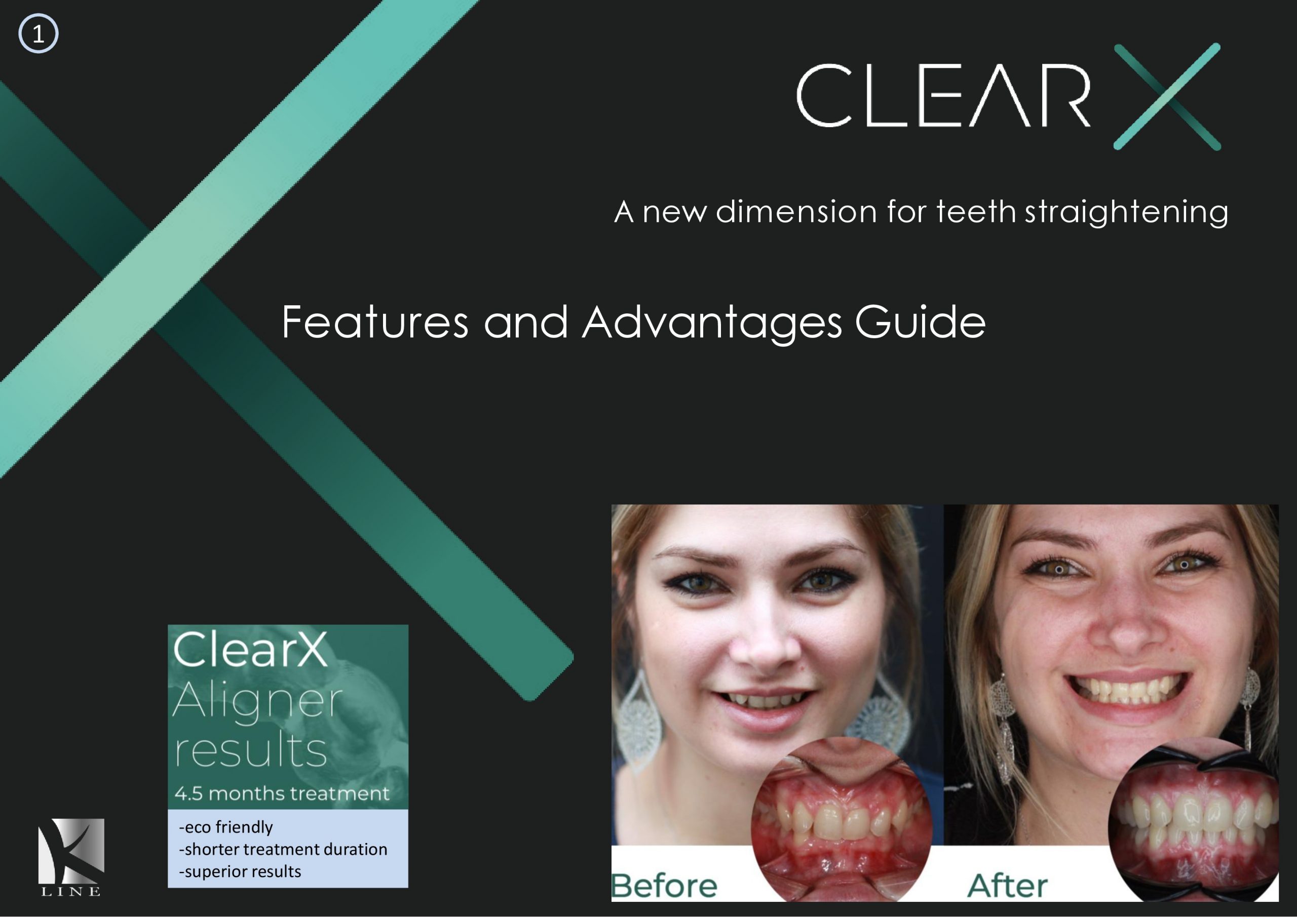 CLEAR X : THE REVOLUTION IN ORTHODONTICS